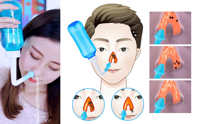 Как правильно промывать нос солевым раствором