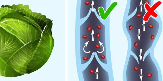 Капуста от варикозного расширения вен