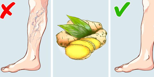 Имбирный чай от варикозного расширения вен